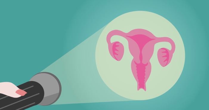 الموسوعة الشاملة عن سرطان عنق الرحم 3 سرطان عنق الرحم