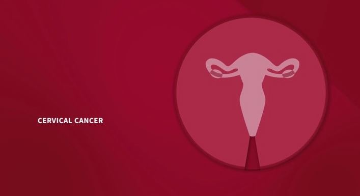 الموسوعة الشاملة عن سرطان عنق الرحم 2 سرطان عنق الرحم