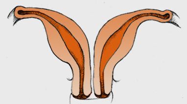 الرحم المزدوج