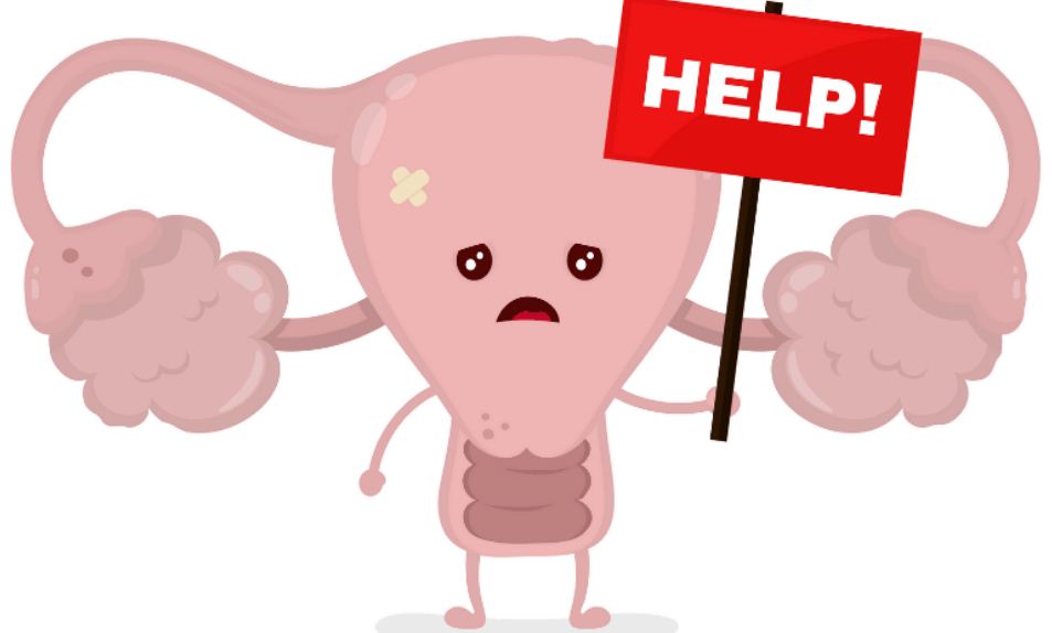 تكيس المبايض