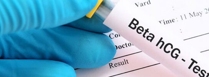 اختبارات الحمل