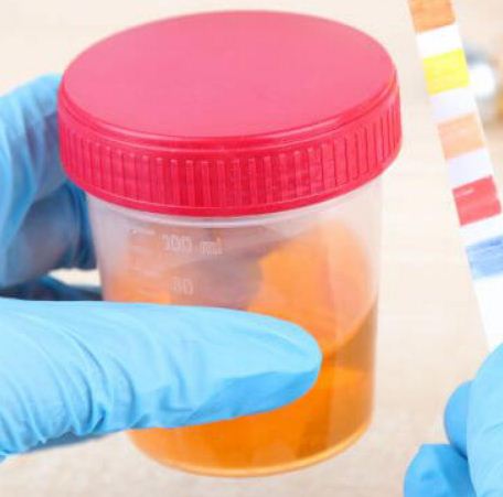 اختبارات الحمل في الاشهر الثلات الثانية من الحمل 2 اختبارات البول اثناء الحمل