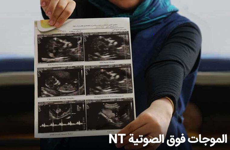 الموجات فوق الصوتية NT اثناء الحمل 2 الموجات فوق الصوتية NT اثناء الحمل