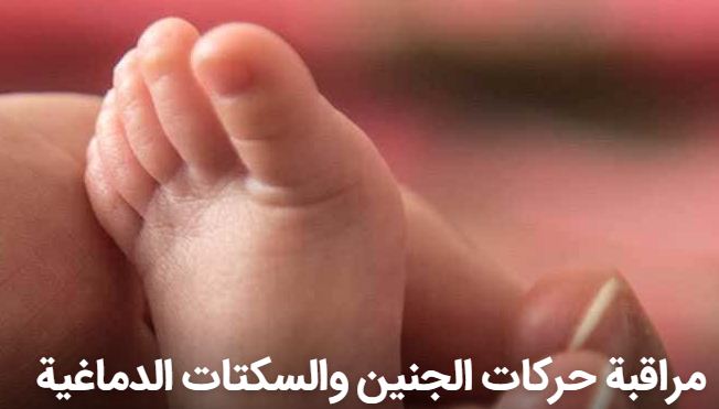 حركات الجنين والسكتات الدماغية